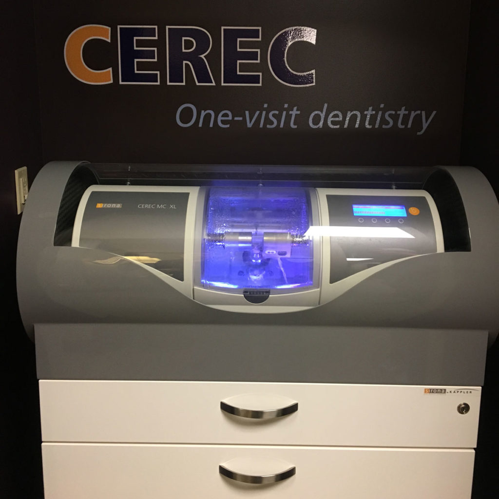 Cerec - Advanced Dentistry in Springfield